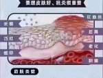 春季过敏高峰期护肤指南：如何应对花粉、日光及螨虫引发的皮肤问题