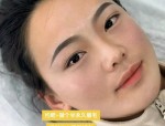 安徽韩美整形外科医院：韩式半永久眉毛的优势与注意事项详解