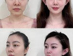 19个整容案例揭秘：从平凡到美丽，后天努力成就精彩人生